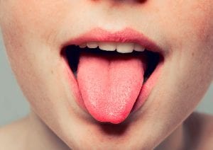 Conheça as principais doenças da língua e saiba como evitá-las