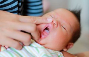 Língua do bebê branca pode indicar problemas bucais? Saiba o que fazer